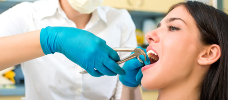 Tooth Extractions in Woodland Hill